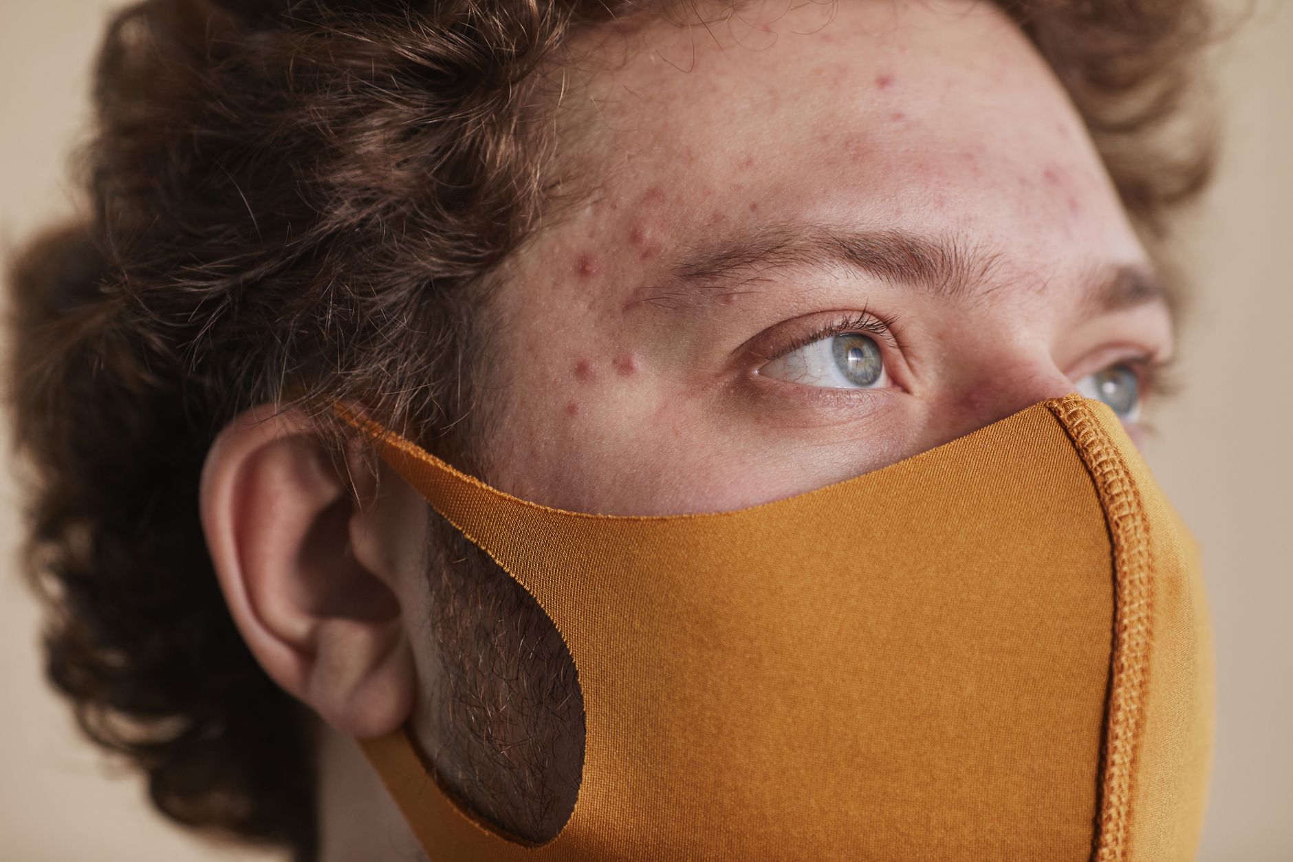 Stress and Acne: How to Manage Breakouts