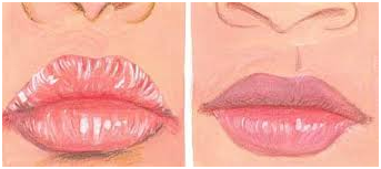 how to get rid of chapped lips overnight