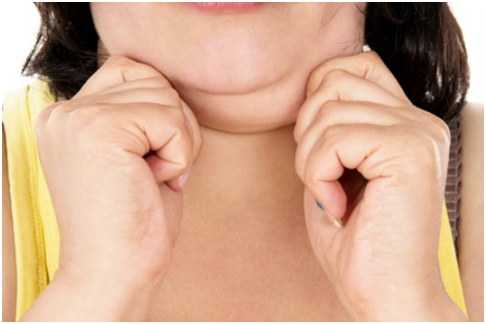 How to get rid of double chin without surgery