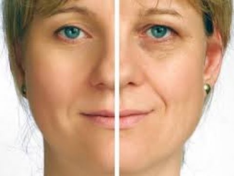 How To get rid of Eye Floaters