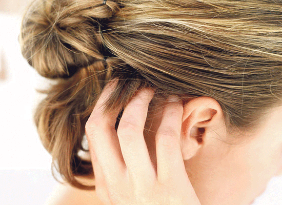 how to get rid of Itchy scalp