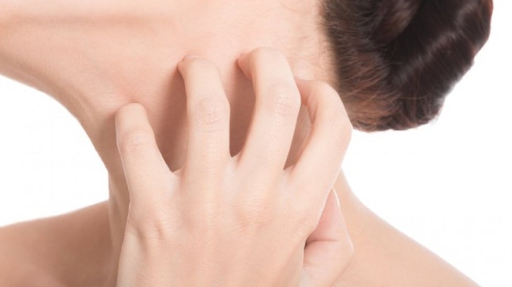 How to get rid of itchy skin 001