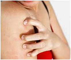 How to get rid of itchy skin