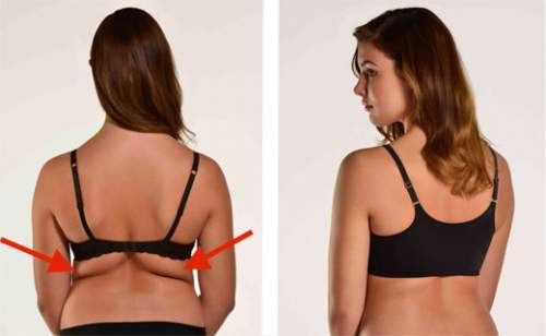 get rid of lower back fat