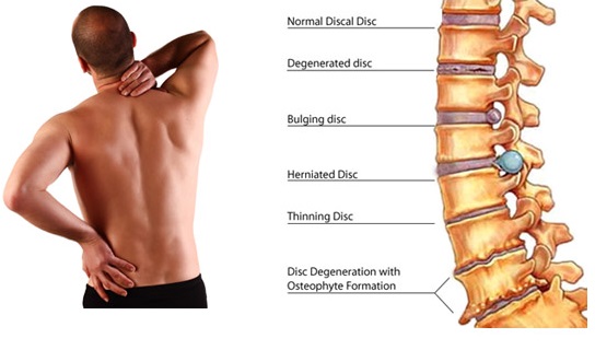 how to get rid of lower back pain