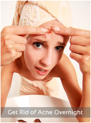 How to Get Rid Of Pimples