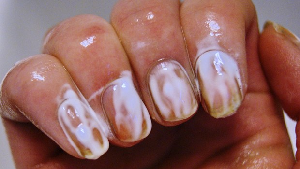 Whitening Toothpaste for yellow nails
