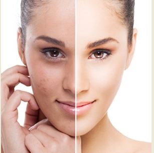 HOW TO LIGHTEN TANNED SKIN NATURALLY
