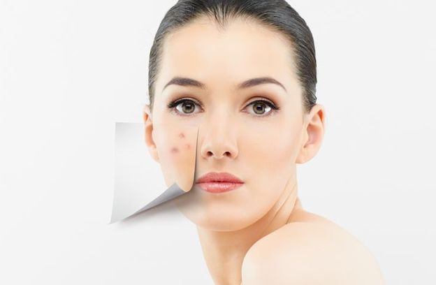 Salicylic Acid Acne Treatment