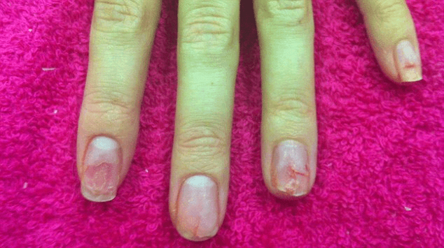 Tips to protect against Infection from artificial nails