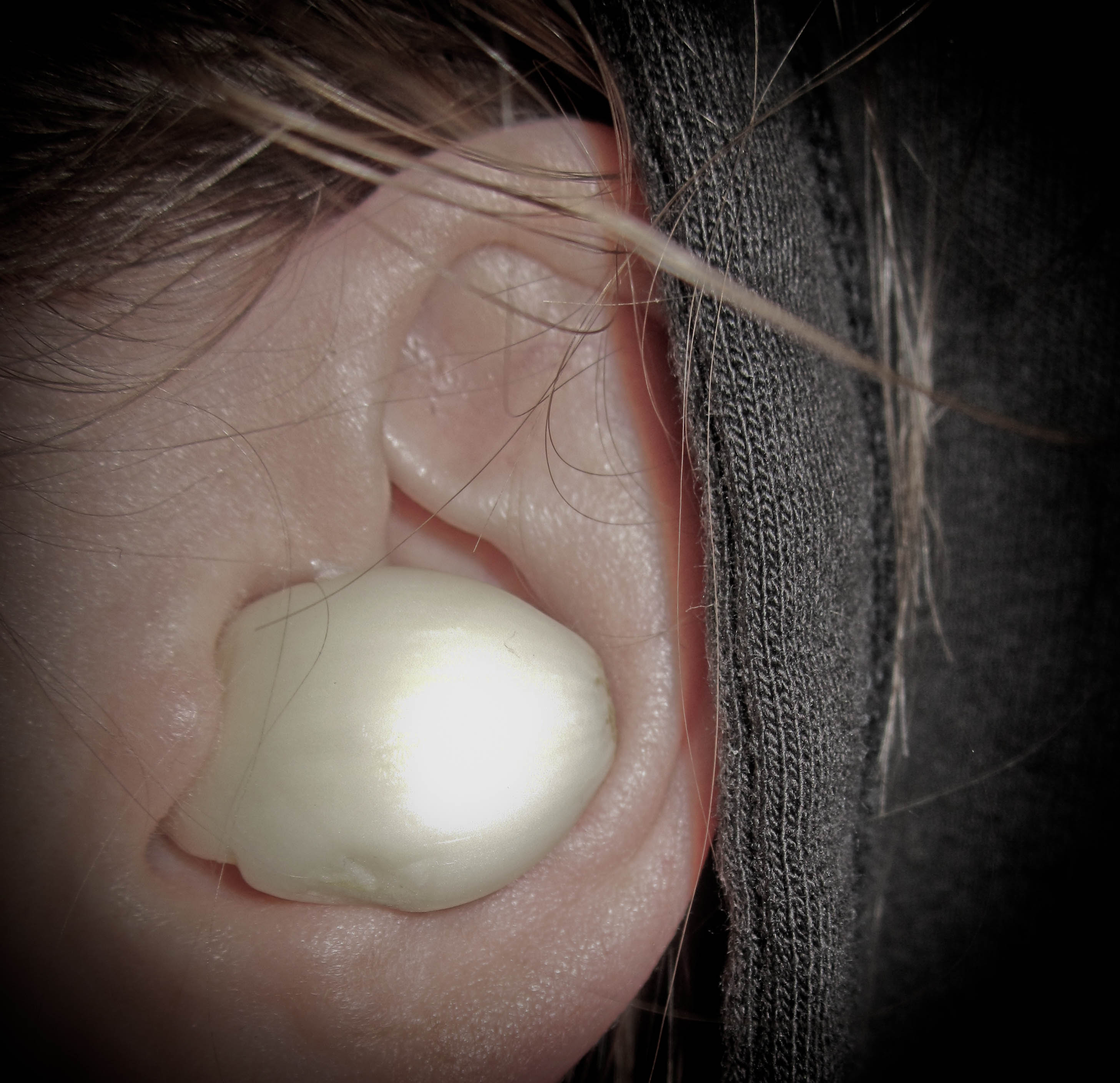 How to get rid of Ear Infection with garlic